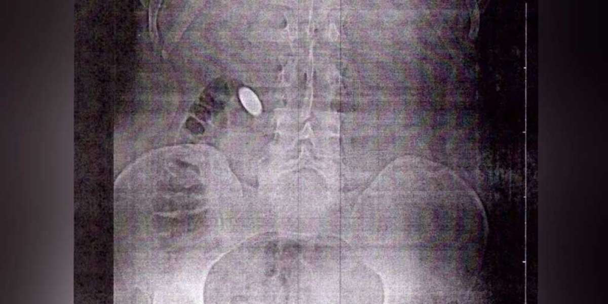 Homem é indiciado por estupro virtual ao extorquir de amigo e forçá-lo a engolir moeda