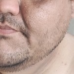Natan