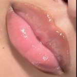 Very hot